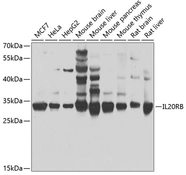 WB analysis of various sample lysates using GTX33262 IL20RB antibody. Dilution : 1:1000 Loading : 25microg per lane