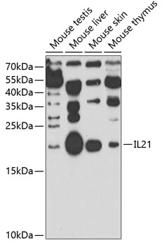 WB analysis of various sample lysates using GTX33263 IL21 antibody. The signal was developed with ECL plus-Enhanced. Dilution : 1:1000 Loading : 25microg per lane WB analysis of various sample lysates using GTX33263 IL21 antibody. The signal was developed with ECL plus-Enhanced. Dilution : 1:1000 Loading : 25microg per lane