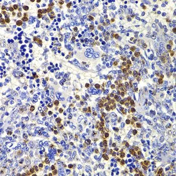 IHC-P analysis of rat spleen tissue using GTX33263 IL21 antibody. Dilution : 1:100