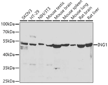 WB analysis of various sample lysates using GTX33265 ING1 antibody. The signal was developed with ECL plus-Enhanced. Dilution : 1:500 Loading : 25microg per lane WB analysis of various sample lysates using GTX33265 ING1 antibody. The signal was developed with ECL plus-Enhanced. Dilution : 1:500 Loading : 25microg per lane