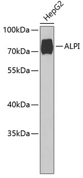 WB analysis of HepG2 cell lysate using GTX33269 Alkaline phosphatase (intestinal) antibody. Dilution : 1:1000 Loading : 25microg per lane WB analysis of HepG2 cell lysate using GTX33269 Alkaline phosphatase (intestinal) antibody. Dilution : 1:1000 Loading : 25microg per lane