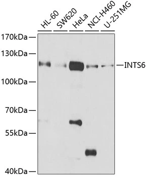 WB analysis of various sample lysates using GTX33271 INTS6 antibody. Dilution : 1:1000 Loading : 25microg per lane WB analysis of various sample lysates using GTX33271 INTS6 antibody. Dilution : 1:1000 Loading : 25microg per lane