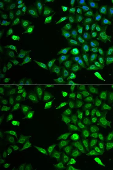 ICC/IF analysis of A549 cells using GTX33271 INTS6 antibody. Blue : DAPI