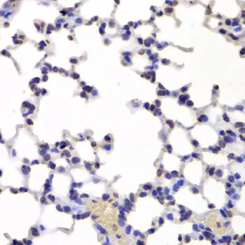 IHC-P analysis of mouse lung tissue using GTX33271 INTS6 antibody. Dilution : 1:100