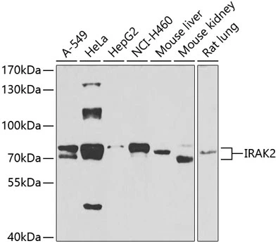 WB analysis of various sample lysates using GTX33273 IRAK2 antibody. Dilution : 1:1000 Loading : 25microg per lane WB analysis of various sample lysates using GTX33273 IRAK2 antibody. Dilution : 1:1000 Loading : 25microg per lane