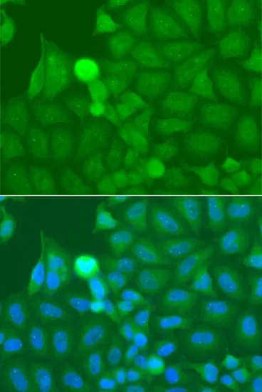 ICC/IF analysis of A549 cells using GTX33273 IRAK2 antibody. Blue : DAPI