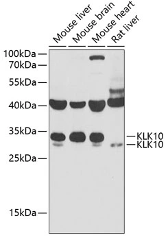 WB analysis of various sample lysates using GTX33280 Kallikrein 10 antibody. Dilution : 1:1000 Loading : 25microg per lane WB analysis of various sample lysates using GTX33280 Kallikrein 10 antibody. Dilution : 1:1000 Loading : 25microg per lane