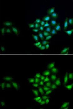 ICC/IF analysis of MCF7 cells using GTX33280 Kallikrein 10 antibody. Blue : DAPI