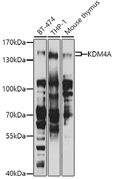 WB analysis of various sample lysates using GTX33282 KDM4A antibody. Dilution : 1:1000 Loading : 25microg per lane WB analysis of various sample lysates using GTX33282 KDM4A antibody. Dilution : 1:1000 Loading : 25microg per lane