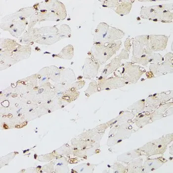 IHC-P analysis of mouse heart tissue using GTX33282 KDM4A antibody. Dilution : 1:100