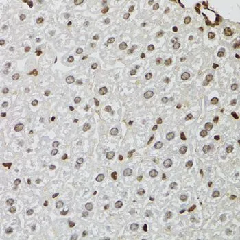 IHC-P analysis of mouse liver tissue using GTX33282 KDM4A antibody. Dilution : 1:100