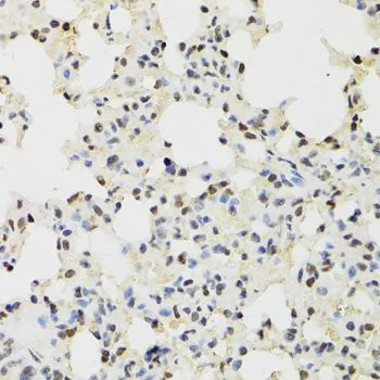 IHC-P analysis of mouse lung tissue using GTX33282 KDM4A antibody. Dilution : 1:100