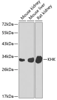WB analysis of various sample lysates using GTX33283 Ketohexokinase antibody. Dilution : 1:1000 Loading : 25microg per lane WB analysis of various sample lysates using GTX33283 Ketohexokinase antibody. Dilution : 1:1000 Loading : 25microg per lane