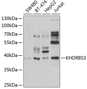 WB analysis of various sample lysates using GTX33284 KHDRBS3 antibody. The signal was developed with ECL plus-Enhanced. Dilution : 1:1000 Loading : 25microg per lane WB analysis of various sample lysates using GTX33284 KHDRBS3 antibody. The signal was developed with ECL plus-Enhanced. Dilution : 1:1000 Loading : 25microg per lane