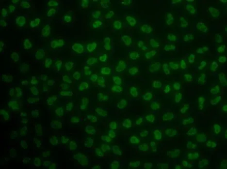 ICC/IF analysis of MCF7 cells using GTX33284 KHDRBS3 antibody.