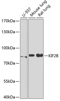 WB analysis of various sample lysates using GTX33286 KIF2B antibody. Dilution : 1:1000 Loading : 25microg per lane WB analysis of various sample lysates using GTX33286 KIF2B antibody. Dilution : 1:1000 Loading : 25microg per lane