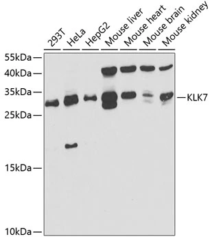 WB analysis of various sample lysates using GTX33289 Kallikrein 7 antibody. Dilution : 1:1000 Loading : 25microg per lane WB analysis of various sample lysates using GTX33289 Kallikrein 7 antibody. Dilution : 1:1000 Loading : 25microg per lane
