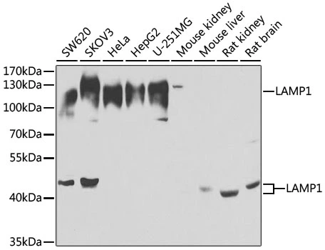 WB analysis of various sample lysates using GTX33293 LAMP1 antibody. Dilution : 1:1000 Loading : 25microg per lane WB analysis of various sample lysates using GTX33293 LAMP1 antibody. Dilution : 1:1000 Loading : 25microg per lane