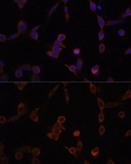 ICC/IF analysis of NIH/3T3 cells using GTX33293 LAMP1 antibody. Blue : DAPI Dilution : 1:100