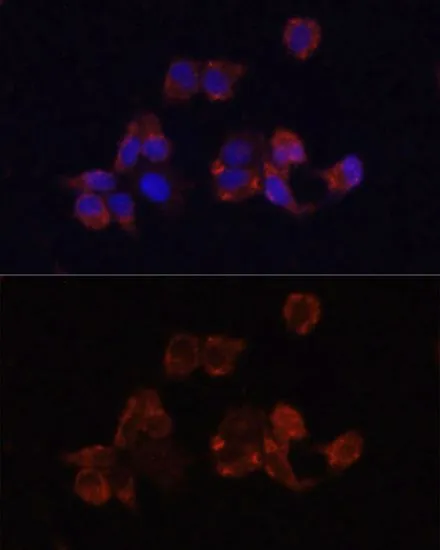 ICC/IF analysis of HeLa cells using GTX33293 LAMP1 antibody. Blue : DAPI Dilution : 1:100