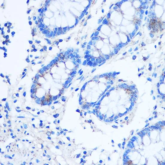 IHC-P analysis of human colon tissue using GTX33302 LRP130 antibody. Dilution : 1:100