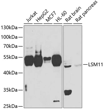 WB analysis of various sample lysates using GTX33303 LSM11 antibody. Dilution : 1:1000 Loading : 25microg per lane WB analysis of various sample lysates using GTX33303 LSM11 antibody. Dilution : 1:1000 Loading : 25microg per lane