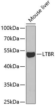 WB analysis of mouse liver tissue lysate using GTX33305 LTBR antibody. Dilution : 1:1000 Loading : 25microg per lane WB analysis of mouse liver tissue lysate using GTX33305 LTBR antibody. Dilution : 1:1000 Loading : 25microg per lane