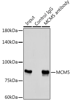 IP analysis of HeLa cell lysate using GTX33310 MCM5 antibody. Antibody amount : 3microg / 300microg lysate Dilution : 1:1000 IP analysis of HeLa cell lysate using GTX33310 MCM5 antibody. Antibody amount : 3microg / 300microg lysate Dilution : 1:1000
