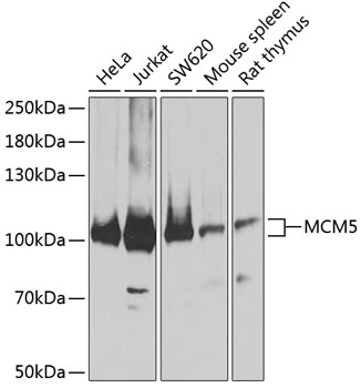 WB analysis of various sample lysates using GTX33310 MCM5 antibody. Dilution : 1:3000 Loading : 25microg per lane