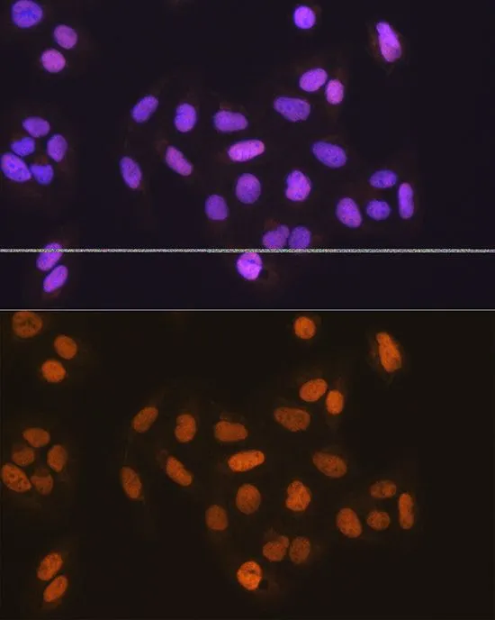 ICC/IF analysis of U2OS cells using GTX33310 MCM5 antibody. Blue : DAPI Dilution : 1:100