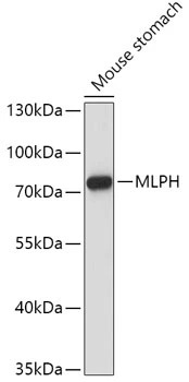 WB analysis of mouse stomach tissue lysate using GTX33313 Melanophilin antibody. Dilution : 1:1000 Loading : 25microg per lane WB analysis of mouse stomach tissue lysate using GTX33313 Melanophilin antibody. Dilution : 1:1000 Loading : 25microg per lane