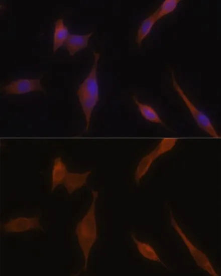 ICC/IF analysis of NIH/3T3 cells using GTX33313 Melanophilin antibody. Blue : DAPI Dilution : 1:100