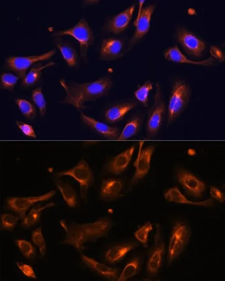 ICC/IF analysis of U2OS cells using GTX33313 Melanophilin antibody. Blue : DAPI Dilution : 1:100