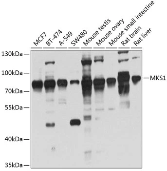 WB analysis of various sample lysates using GTX33319 MKS1 antibody. Dilution : 1:1000 Loading : 25microg per lane WB analysis of various sample lysates using GTX33319 MKS1 antibody. Dilution : 1:1000 Loading : 25microg per lane