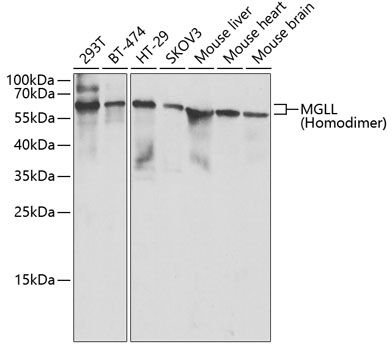 WB analysis of various samples using GTX33321 Monoglyceride lipase antibody. Dilution : 1:1000 Loading : 25ug per lane