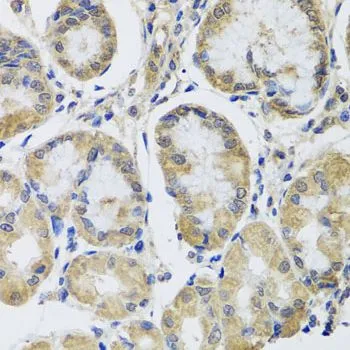 IHC-P analysis of human stomach tissue using GTX33325 MRPL1 antibody. Dilution : 1:100
