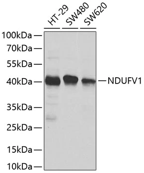 WB analysis of various sample lysates using GTX33351 NDUFV1 antibody. Dilution : 1:1000 Loading : 25microg per lane WB analysis of various sample lysates using GTX33351 NDUFV1 antibody. Dilution : 1:1000 Loading : 25microg per lane