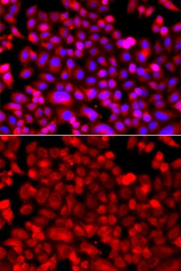 ICC/IF analysis of A549 cells using GTX33351 NDUFV1 antibody. Blue : DAPI