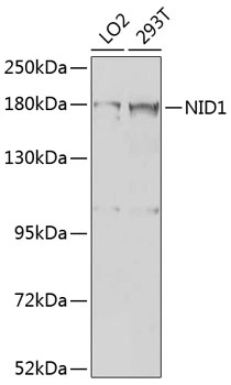 WB analysis of various sample lysates using GTX33357 Nidogen 1 antibody. Dilution : 1:1000 Loading : 25microg per lane WB analysis of various sample lysates using GTX33357 Nidogen 1 antibody. Dilution : 1:1000 Loading : 25microg per lane