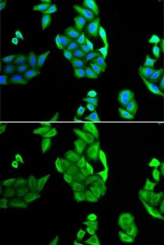 ICC/IF analysis of U2OS cells using GTX33361 NOL3 antibody. Blue : DAPI