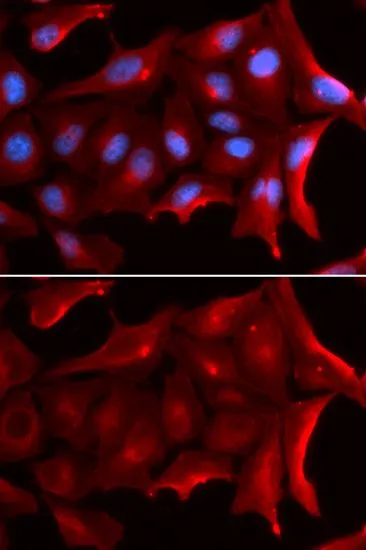 ICC/IF analysis of U2OS cells using GTX33363 NQO2 antibody. Blue : DAPI