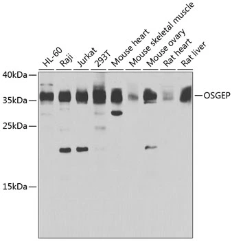WB analysis of various sample lysates using GTX33375 OSGEP antibody. Dilution : 1:1000 Loading : 25microg per lane WB analysis of various sample lysates using GTX33375 OSGEP antibody. Dilution : 1:1000 Loading : 25microg per lane