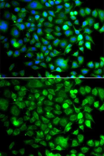ICC/IF analysis of A549 cells using GTX33375 OSGEP antibody. Blue : DAPI