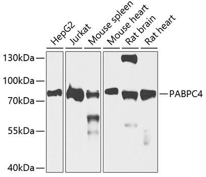 WB analysis of various sample lysates using GTX33380 PABPC4 antibody. Dilution : 1:1000 Loading : 25microg per lane WB analysis of various sample lysates using GTX33380 PABPC4 antibody. Dilution : 1:1000 Loading : 25microg per lane