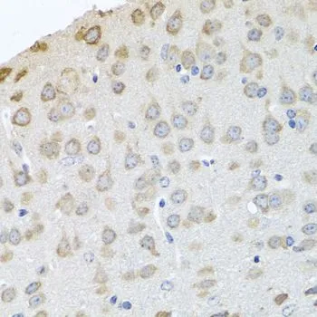 IHC-P analysis of mouse brain tissue using GTX33380 PABPC4 antibody. Dilution : 1:100