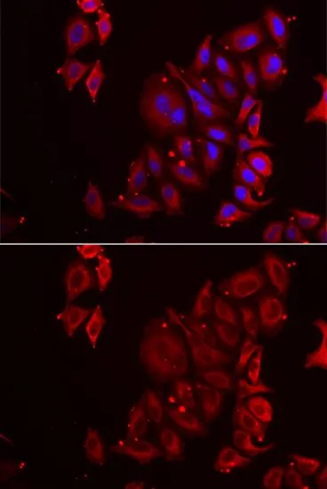 ICC/IF analysis of U2OS cells using GTX33382 PAICS antibody. Blue : DAPI