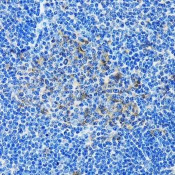 IHC-P analysis of rat spleen tissue using GTX33382 PAICS antibody. Dilution : 1:100