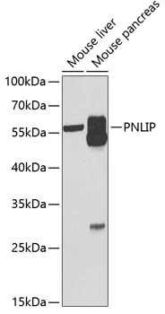 WB analysis of various sample lysates using GTX33384 Pancreatic Lipase antibody. Dilution : 1:1000 Loading : 25microg per lane WB analysis of various sample lysates using GTX33384 Pancreatic Lipase antibody. Dilution : 1:1000 Loading : 25microg per lane