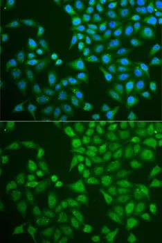 ICC/IF analysis of U2OS cells using GTX33384 Pancreatic Lipase antibody. Blue : DAPI
