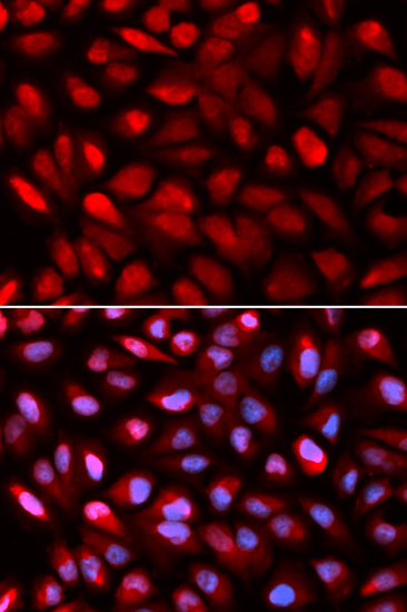 IHC-P analysis of mouse heart tissue using GTX33389 PCBP2 antibody. Dilution : 1:100